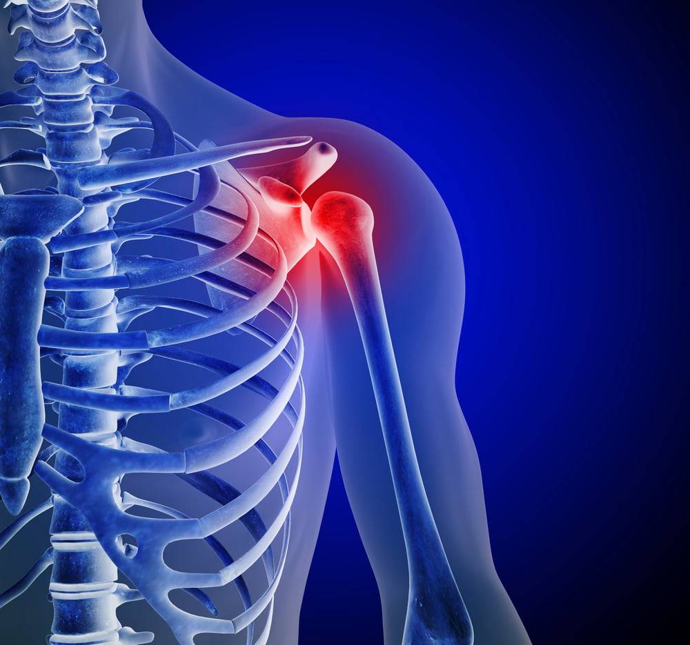blue skeleton shoulder pain